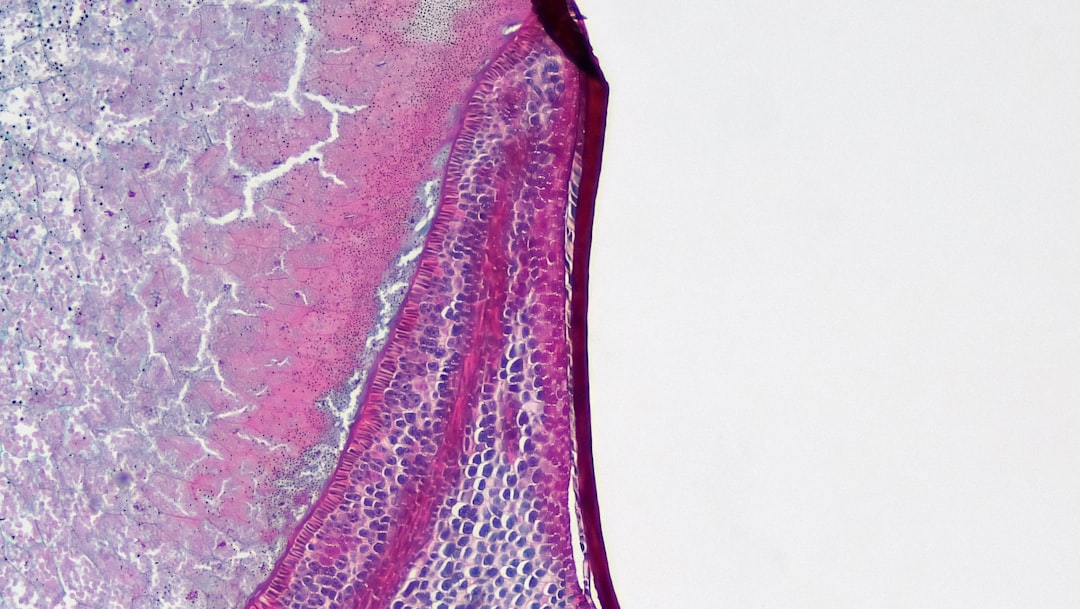 l'hématurie est la présence de sang dans les urines, pouvant indiquer diverses conditions médicales. découvrez les causes, symptômes et traitements possibles.